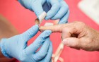 Das richtige Wundpflaster: So werden Verletzungen ideal versorgt