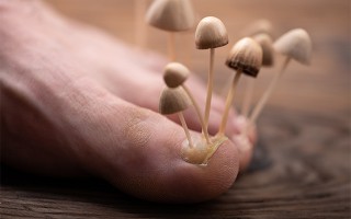 Nagelpilz