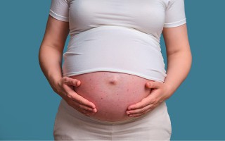 Haut in der Schwangerschaft